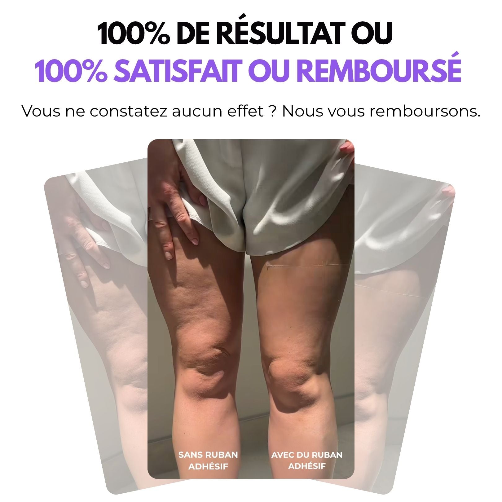LIFTING TAPES | Sofort-Lift gegen Cellulite