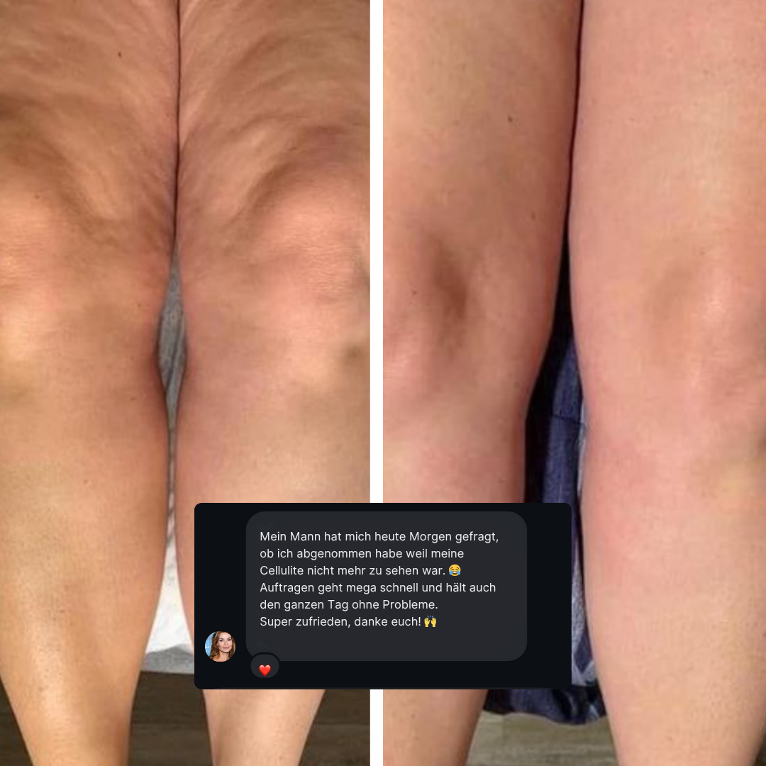 LIFTING TAPES | Sofort-Lift gegen Cellulite