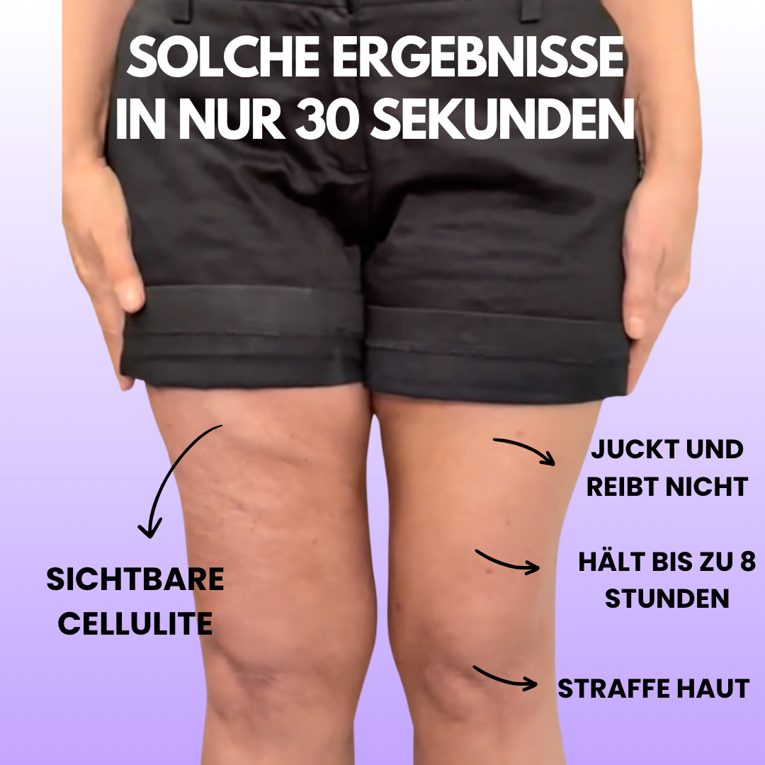 LIFTING TAPES | Sofort-Lift gegen Cellulite
