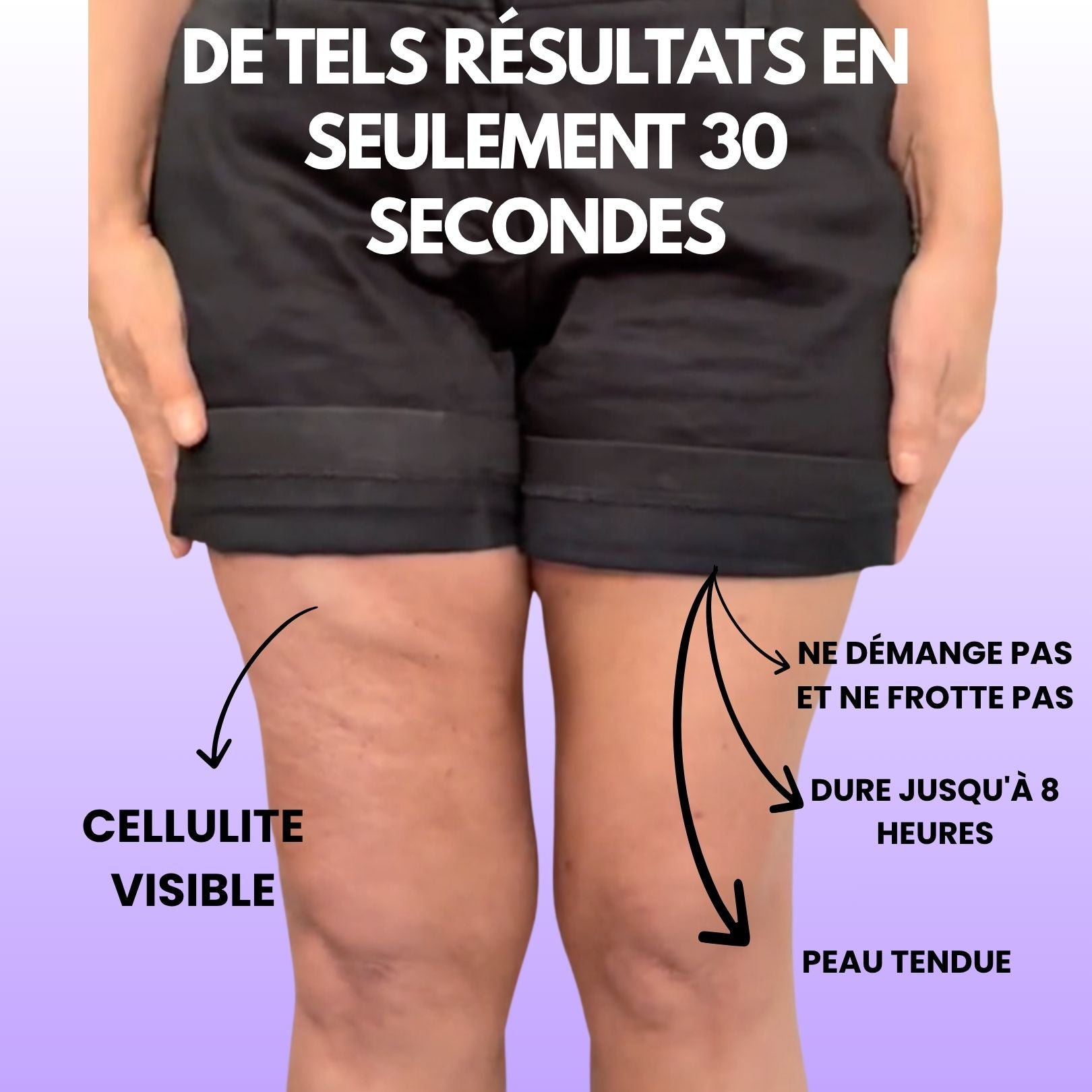 LIFTING TAPES | Sofort-Lift gegen Cellulite